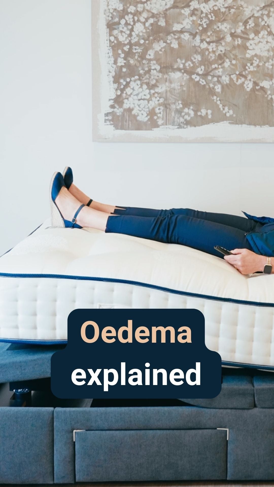 A woman laid on an adjustable bed with her legs elevated with the caption 'Oedema explained'