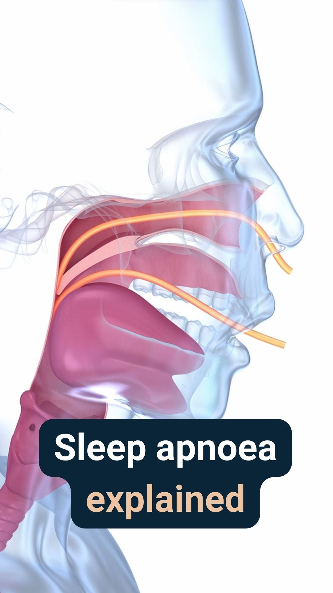 An illustrated diagram of the airways in the human head, with the caption 'Sleep apnoea explained'